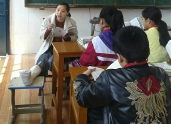 乡村教师腿骨折打石膏授课1_副本.jpg