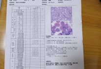 患者病例