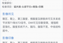 患者诊断结果