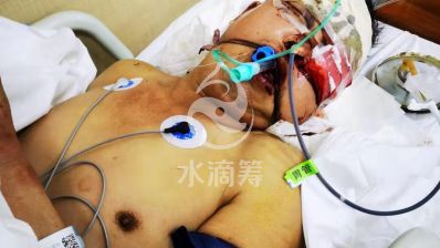 父母双双发生意外，父亲生命垂危，救救他！