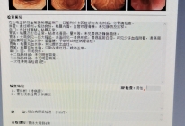 患者诊断结果