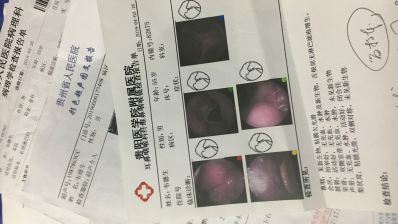 老爸请不要被鼻咽癌打倒！这个家还需要你