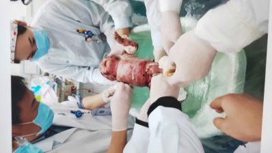 【我只想宝宝健康长大】来自一名普通父亲的求助！